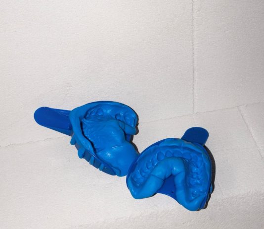 Eduard Popescu – Un amore senza fine