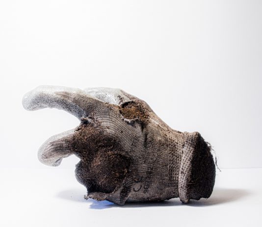 C.A. Castro Lobato – Tobillo Torcido (Caviglia storta) C.A. Castro Lobato – Tobillo Torcido (Caviglia storta)