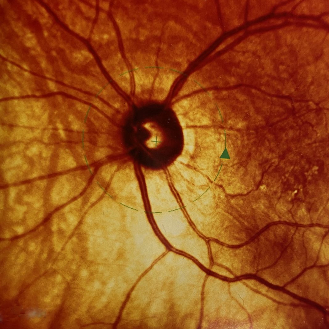 Margherita Taticchi –  In-Visibilia / le visibili cose invisibilihttps://www.exibart.com/repository/media/formidable/11/img/839/IN-VISIBILIA-foto-1-1068x1068.jpg