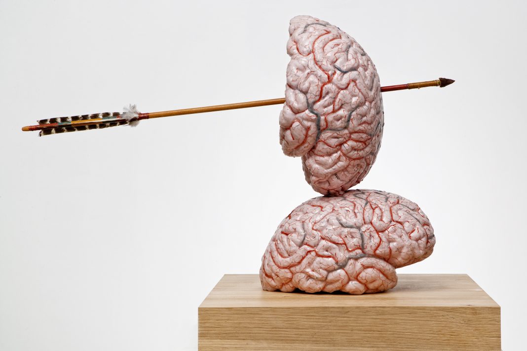 Jan Fabre – Brain thinking models and drawingshttps://www.exibart.com/repository/media/formidable/11/img/fec/JanFabre_2-1068x712.jpg